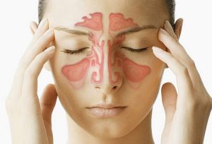 sinusitis1(1)