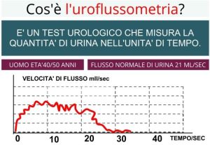 Uroflussometria a Bari