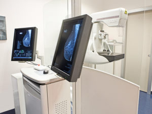 mammografia digitale