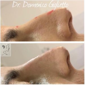 Rinofiller dott Giglietto